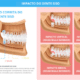 Gráfico educativo mostrando diferentes tipos de impacção dos dentes do siso na mandíbula, com detalhes claros sobre posições vertical, horizontal, mesial e distal. Essencial para entender quando é necessário avaliar o siso para tratamento ortodôntico ou remoção.